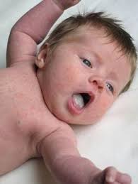 Was Beruhrt Der Weisse Auf Der Zunge Des Babys