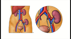 Kidney Transplantation The Operation Youtube The kidneys filter waste from the blood and remove it from the body. kidney transplantation the operation