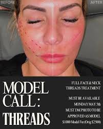 Combo Brow healing process 🤍 Microblading + Machine Shading. By @_jannimal  Trust the process! Brows will be dark to start, may disappear for a few  days then they will heal soft & natural 👏🏼