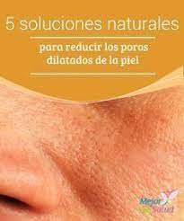 5 Soluciones Naturales Para Reducir Los Poros Dilatados De La Piel Mejor Con Salud Reducir Los Poros Belleza De Cara Tratamientos De Belleza