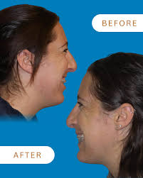 You don't usually expect to find a garden at an oral surgery office…but  that's exactly what makes Bluebird special 🌱✨ We designed our space to  feel peaceful and inviting—because your care experience