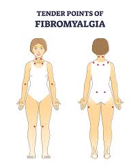 Image result for Fibromyalgia