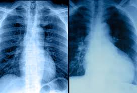 A Visual Guide To Heart Disease Will pay going rate for stock imagery. a visual guide to heart disease