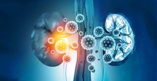 Renal infection and pregnancy outcome. 6 Causes Of Kidney Failure Preferred Vascular Group