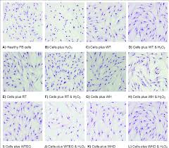 We did not find results for: Light Microscope Images Of Fibroblast Cells 400 With The Extract And Download Scientific Diagram