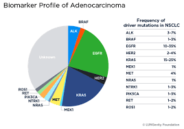 5 Adeno Pie Chart Lung Cancer Pie Chart Www