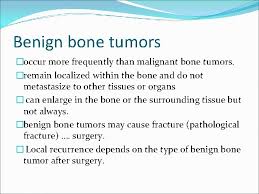 Benign bone tumors are noncancerous growths in or on bones. Bone Tumors Dr Mohammad Q Hamdan Overview Bone