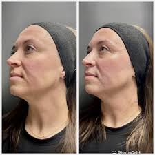 THE BEST 10 DIETITIANS in FREMONT, CA