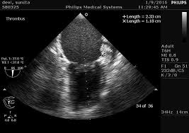 Case Report Archives