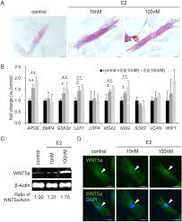 Hair loss from menopausal hormone deficiencies can take many forms. Reversal Of The Hair Loss Phenotype By Modulating The Estradiol Angpt2 Axis In The Mouse Model Of Female Pattern Hair Loss Journal Of Dermatological Science