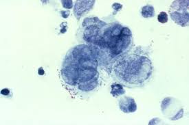 Sweet Lullaby Scientists Uncover How Herpes Virus Sleeps And Wakes Live Science