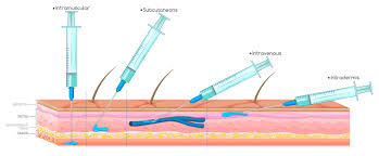 Image result for Subcutaneous Injection