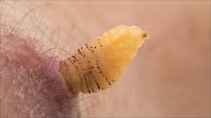 Researcher raises botflies under his skin I NOVA I PBS - YouTube