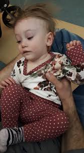 Kitten's hydrocephalus diagnosis and treatment update