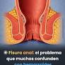 "FISURA ANAL" "MAYO CLINIC" de www.facebook.com