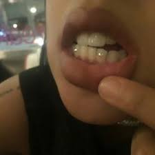 Tooth Gems Omg I Need These Tooth Gem Teeth Jewelry Teeth