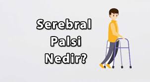 Belirti ve semptomlar bebeklik döneminde veya okul. Serebral Palsi Nedir Risk Faktorleri Ve Siniflama Fizyoo