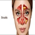Sinusitis Treatment product image
