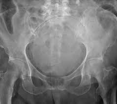Pin On Xrays
