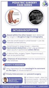 Image result for Intussusception