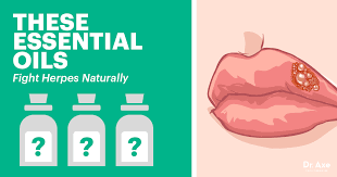 Foods to avoid with a herpes outbreak are; How To Get Rid Of Herpes Symptoms Naturally Dr Axe
