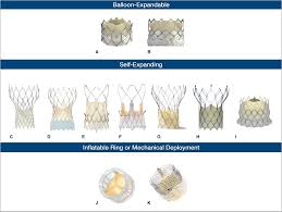 Transcatheter Mitral Valve Replacement In The Transcatheter Aortic Valve Replacement Era Journal Of The American Heart Association