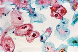 Image result for Pap Smear