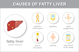 The Causes Of Fatty Liver Disease Fatty Liver Diet Liver Fatty Liver