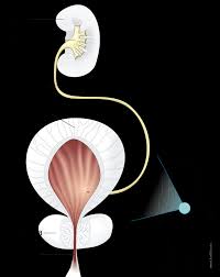 Legene skiller gjerne mellom blod i urinen som er synlig med det blotte øyet og blod som bare kan fanges opp i en hos kvinner kan det ofte være vanskelig å skille blod fra underlivet, mens hos menn er sykdom i prostata relativt ofte årsaken til blødningen. Kreft I Urinblaeren