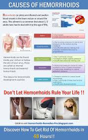 Pin On Hemorrhoids Remedies