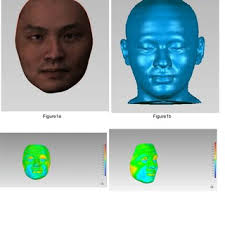 PDF) Hard and soft-tissue symmetry correlations in different facial  aesthetic subunits: A retrospective study