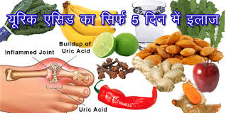 Uric Acid Food Chart In Hindi Www Bedowntowndaytona Com