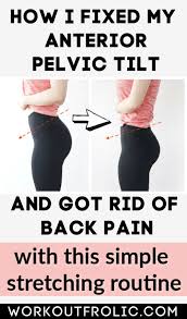 Lower Back Stretch Routine Plus Anterior Pelvic Tilt Advice Update 2020 Fix Your Apt In 2020 Pelvic Tilt Stretch Routine Lower Back