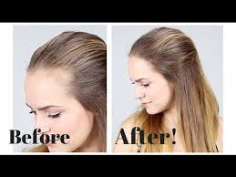Treatment is based on what has caused an uneven hairline. How To Hide Recession In Your Hair Line Quick And Easy Tips And Tricks Hairstyles For Receding Hairline Receding Hair Styles Hair Lines