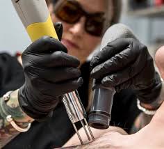 Ways to make tattoo removal hurt less. Lansing Laser Precision Tattoo Removal On Schedulicity