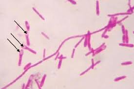 Image result for Clostridium