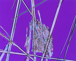 Image result for Polarized Microscopy