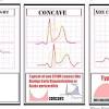 Myokarditis (herzmuskelentzündung) im ekg können veränderungen im kurvenbild oder herzrhythmusstörungen nachgewiesen werden. 1
