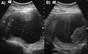 Copyright © by harpercollins publishers. Ultrasonido Uterino A Imagen Anecoica Bien Delimitada Por La Pared Download Scientific Diagram