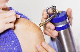 Image result for Cryotherapy