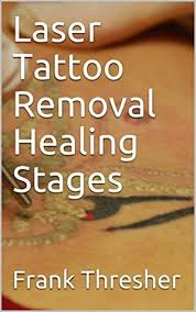 As a dermatologist, i can tell you that these are avoid scratching, rubbing, picking at scabs, and physically removing peeling skin. Laser Tattoo Removal Healing Stages By Frank Thresher