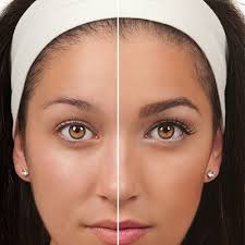 In terms of best practice, it is important to treat your brows with care, says burg. Hair Loss Treatments Hair Beard Mustache Infographics