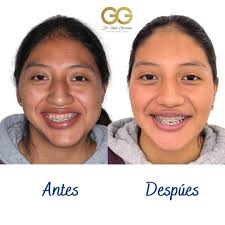 Galo Fernando Guzmán Castillo (@galofernandogc) • Instagram फोटोहरू र  भिडियोहरू