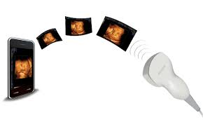 Um sich davon zu überzeugen, dass die wirkung von ultraschallgerät schwangerschaft für zuhause auch in der praxis nützlich ist, schadet es nichts einen blick auf erfahrungen aus foren und testberichte von anwendern zu werfen.es gibt bedauerlicherweise ausgesprochen wenige klinische tests diesbezüglich, denn. 3d Ultraschall 4d Ultraschall Fur Die Ganze Familie