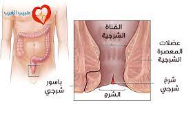 الشرخ الشرجي عند الأطفال صيدلية
