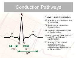 Ecg Interpretation The Basics