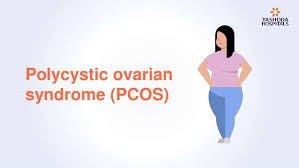 This can't cure pcos, but it helps reduce symptoms and prevent some health problems. Polycystic Ovary Syndrome Pcos Symptoms Causes And Treatment