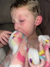 Elisha Ray went to the oncologist today for his AFP to be rechecked. It has  doubled again and is 71 now. His oncologist wants a PET scan. We're just  praying and believing