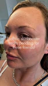 Danielle Rose Aesthetics (@danielleroseaesthetics) · Southampton