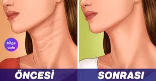 Boyun Cizgilerinizi Yok Edecek Ve Sizi Genc Gosterecek Yontemler 2020 Gencler Saglik Bilgi